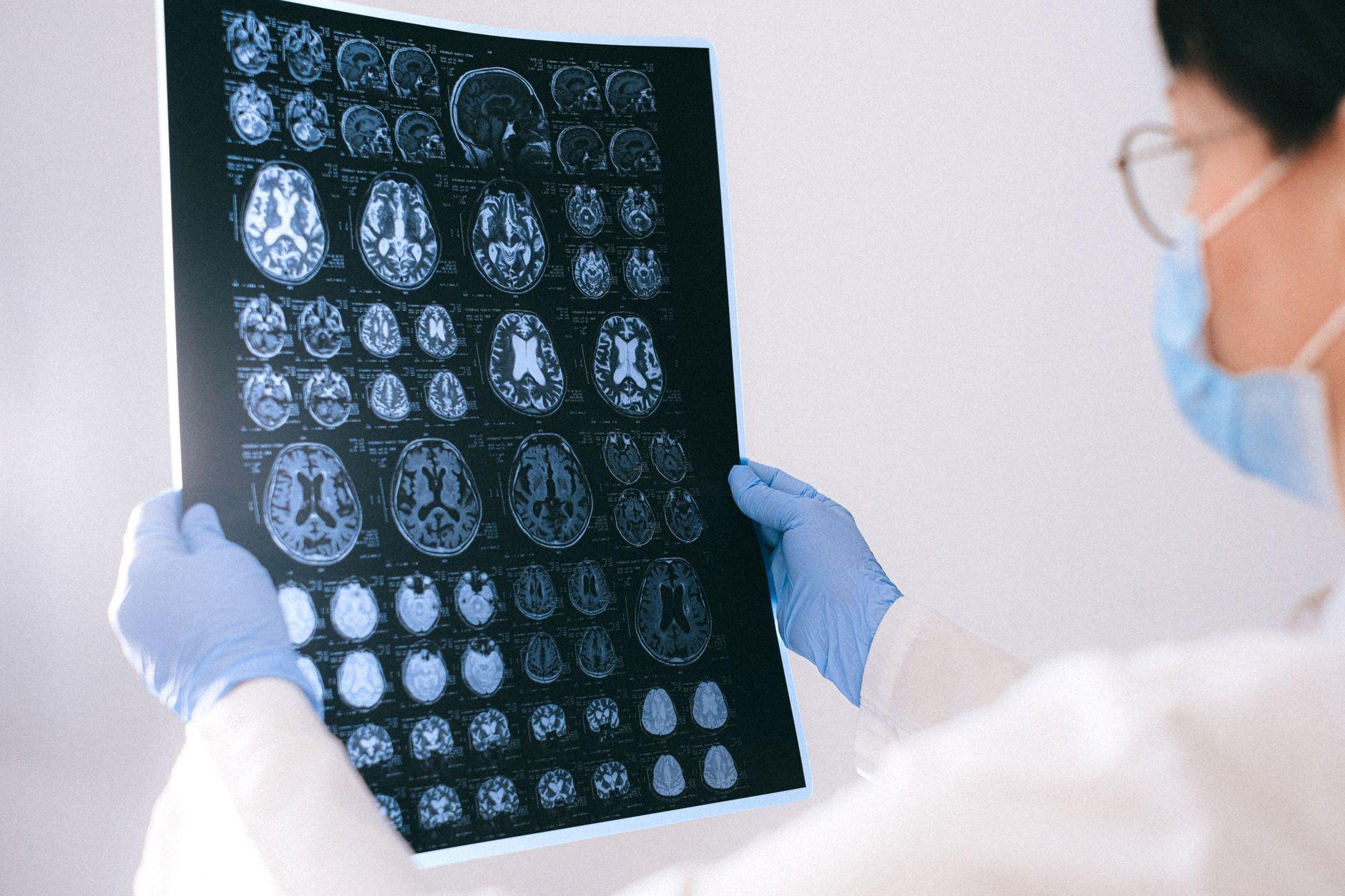 医療画像アノテーター AI支援 おすすめ 単価 2026｜医療画像アノテーションを助けるAIを単価紹介